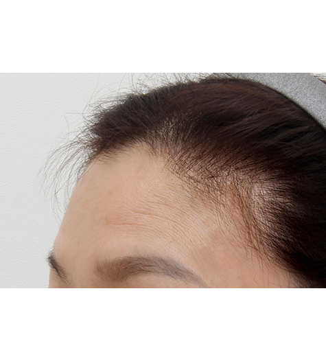 Before Image 3