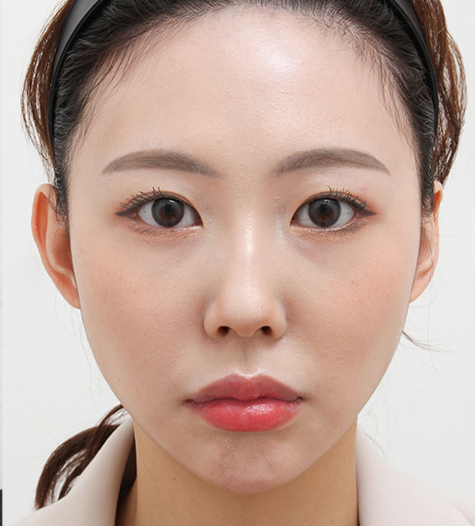 Before Image