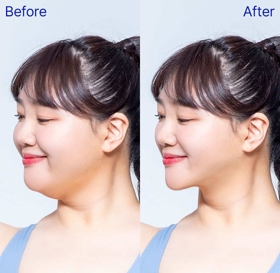 모델